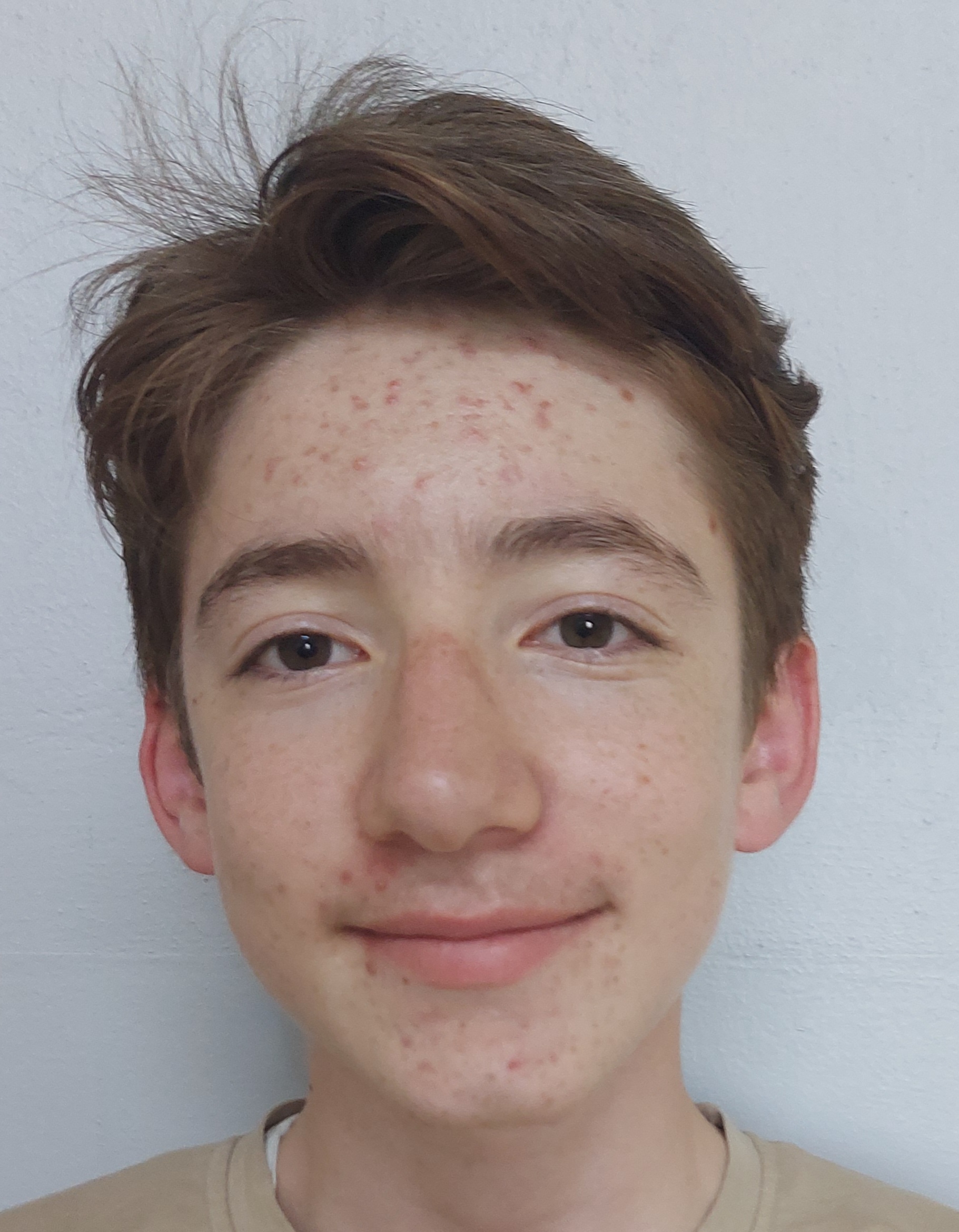 Musab G.